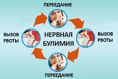 Лечение булимии в Нягани
